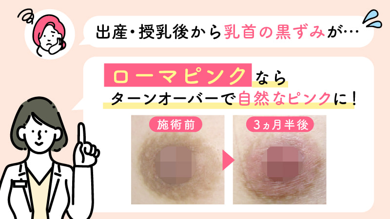 出産・授乳後の乳首の黒ずみはローマピンクで自然なピンク色に