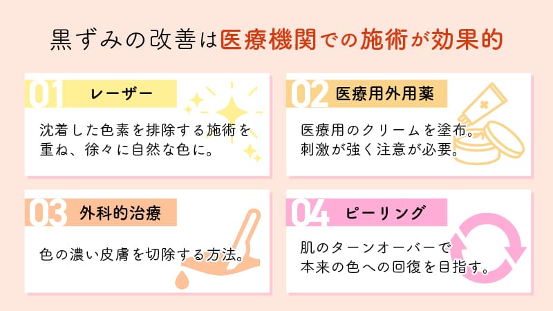 黒ずみの改善は医療機関での施術が効果的