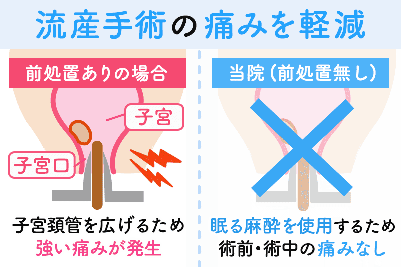 流産手術の痛みを軽減｜前処置有の場合と前処置なしの場合を比較したイメージ